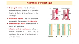 Anomalies of Oesophagus
• Oesophageal atresia: due to deviation of
tracheooesophageal septum in a posterior
direction or F...