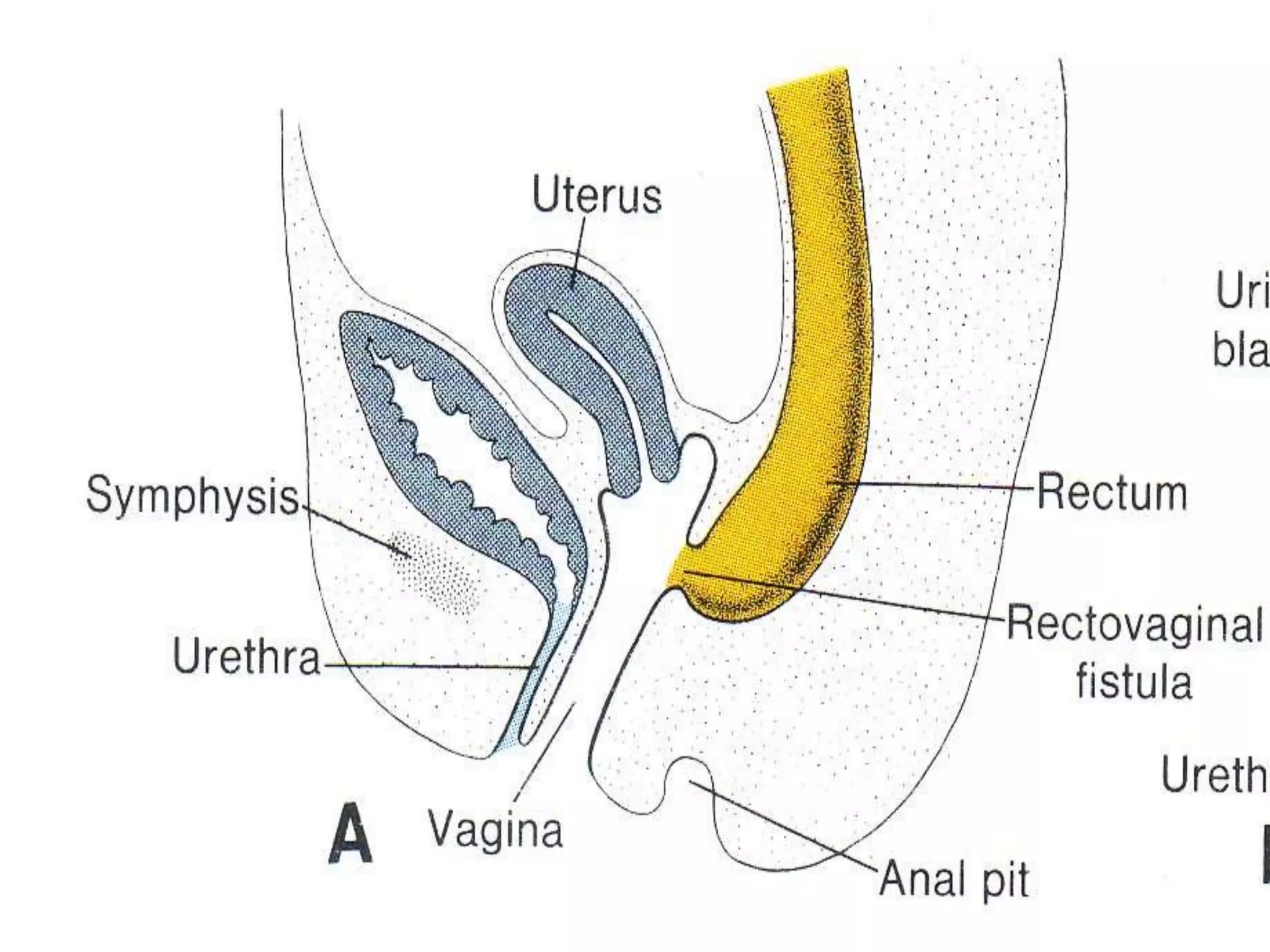 Development of FOREGUT MIDGUT AND HINDGUT.ppt