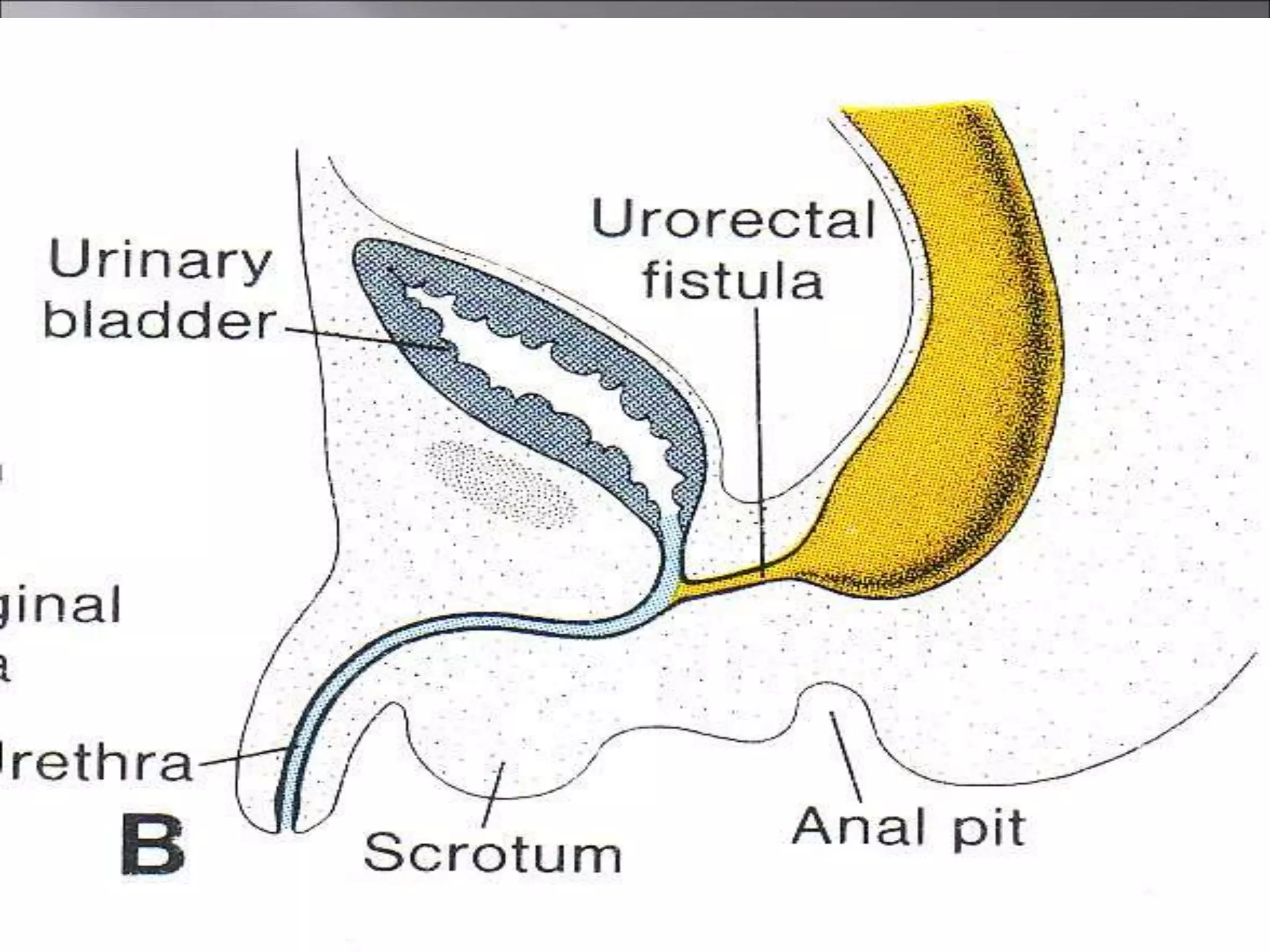 Development of FOREGUT MIDGUT AND HINDGUT.ppt