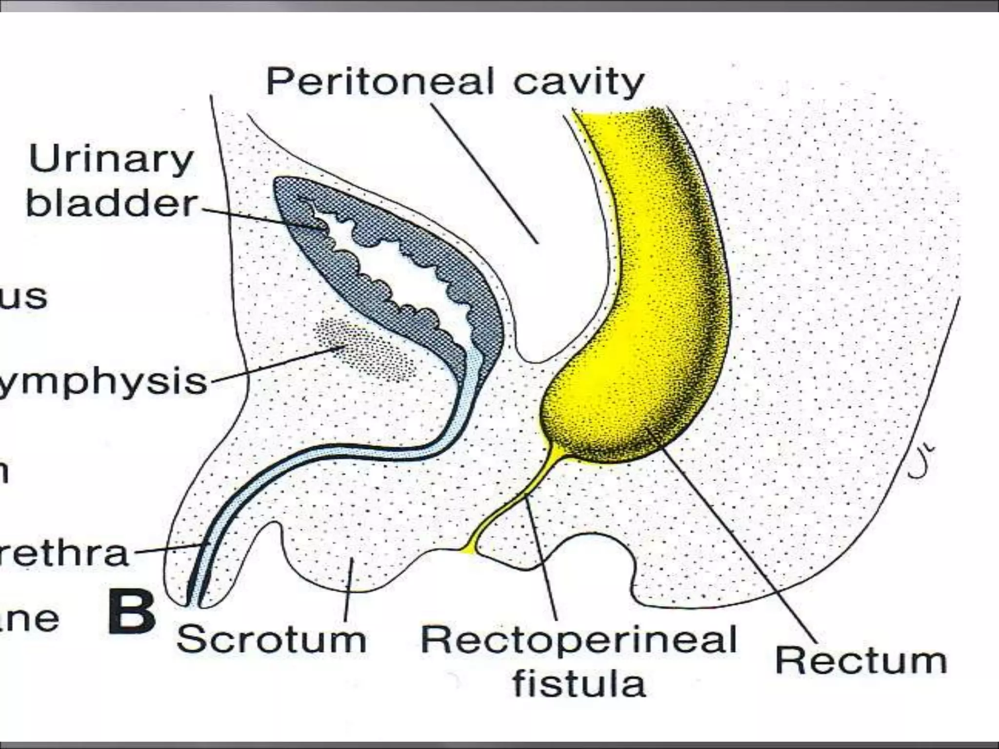 Development of FOREGUT MIDGUT AND HINDGUT.ppt