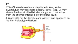 • CT
• CT is of limited value in uncomplicated cases, as the
diverticulum may resemble a normal bowel loop. CT may
show a fluid- or air-filled blind-ending pouch that arises
from the antimesenteric side of the distal ileum.
• It is possible for the diverticulum to invert and appear as an
intraluminal polypoid lesion 1
 