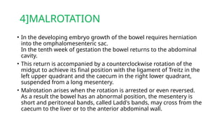 4]MALROTATION
• In the developing embryo growth of the bowel requires herniation
into the omphalomesenteric sac.
In the tenth week of gestation the bowel returns to the abdominal
cavity.
• This return is accompanied by a counterclockwise rotation of the
midgut to achieve its final position with the ligament of Treitz in the
left upper quadrant and the caecum in the right lower quadrant,
suspended from a long mesentery.
• Malrotation arises when the rotation is arrested or even reversed.
As a result the bowel has an abnormal position, the mesentery is
short and peritoneal bands, called Ladd's bands, may cross from the
caecum to the liver or to the anterior abdominal wall.
 