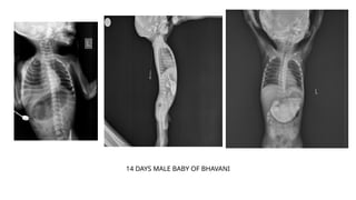 14 DAYS MALE BABY OF BHAVANI
 