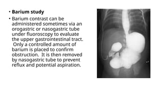 • Barium study
• Barium contrast can be
administered sometimes via an
orogastric or nasogastric tube
under fluoroscopy to evaluate
the upper gastrointestinal tract.
Only a controlled amount of
barium is placed to confirm
obstruction. It is then removed
by nasogastric tube to prevent
reflux and potential aspiration.
 