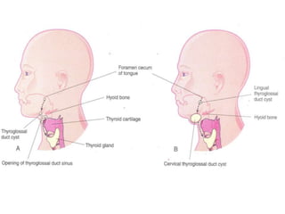 Development of head and neck editted