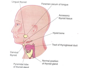 Development of head and neck editted