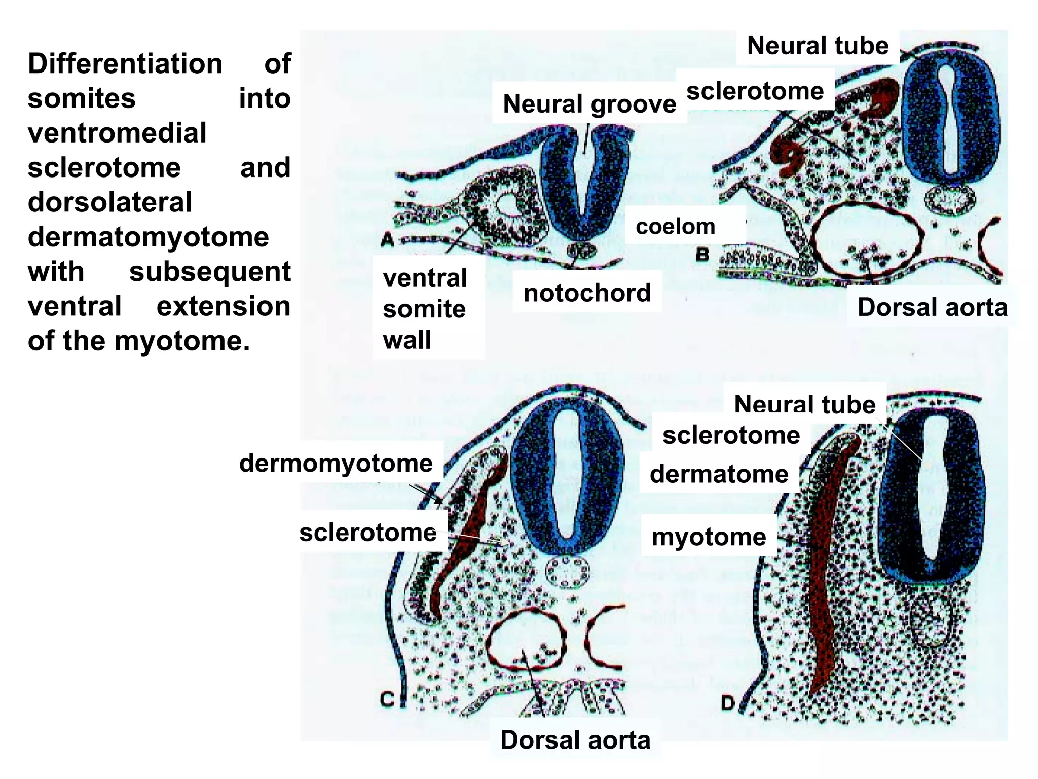Differentiation of somites into ventromedial sclerotome and dorsolateral dermatomyotome with subsequent ventral extension of the myotome . Dorsal aorta sclerotome dermomyotome Neural tube sclerotome dermatome myotome Neural groove ventral  somite wall notochord coelom sclerotome Neural tube Dorsal aorta 