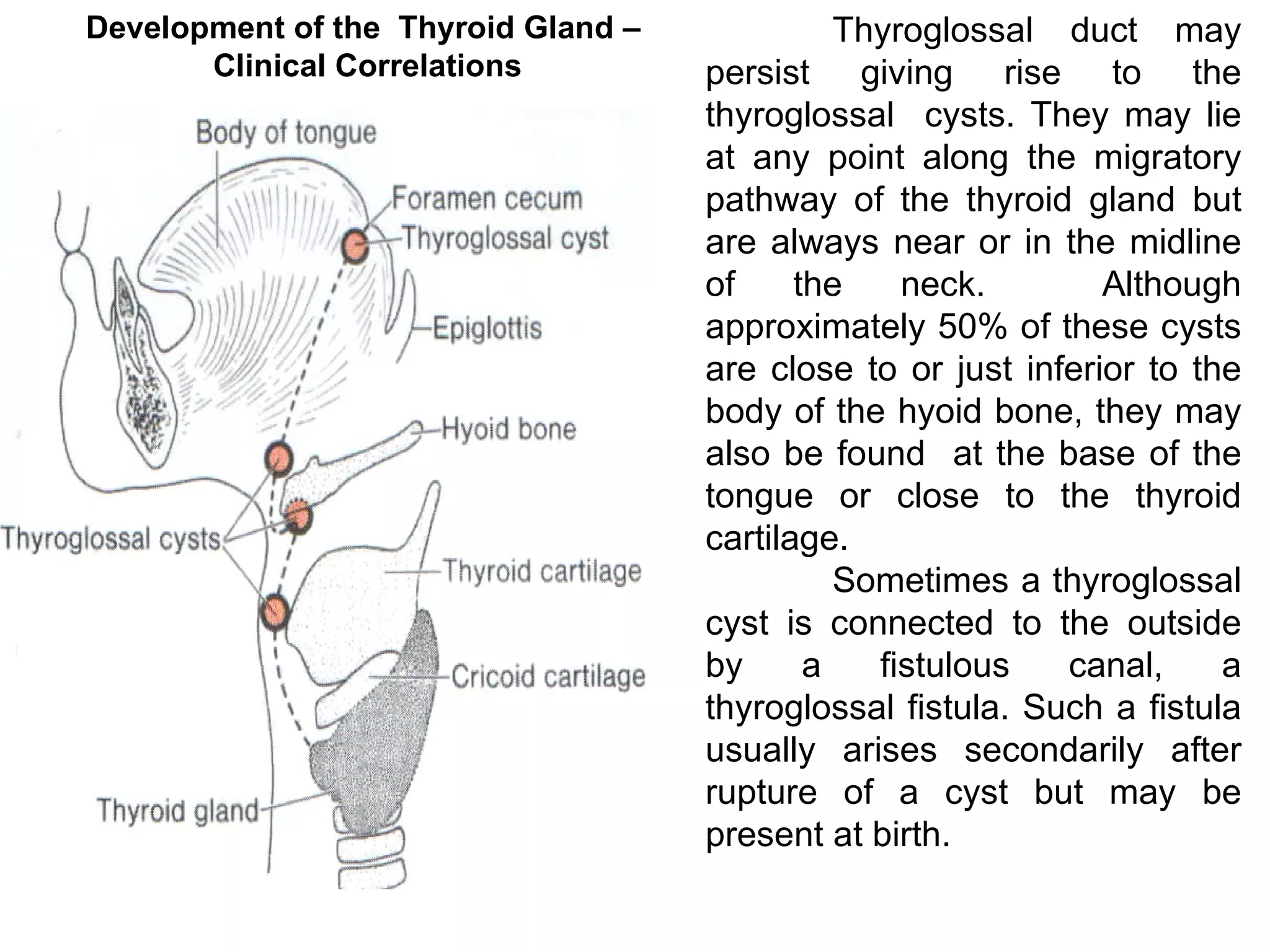 Thyroglossal duct may persist giving rise to the thyroglossal  cysts .  They may lie at any point along the migratory pathway of the thyroid gland but are always near or in the midline of the neck.  Although approximately  50%  of these cysts are close to or just inferior to the body of the hyoid bone, they may also be found  at the base of the tongue or   close to the thyroid cartilage.  Sometimes a thyroglossal cyst is connected to the outside by a fistulous canal, a thyroglossal fistula. Such a fistula usually arises secondarily after rupture of a cyst but may be present at birth.  Development of the  Thyroid Gland –  Clinical Correlations 