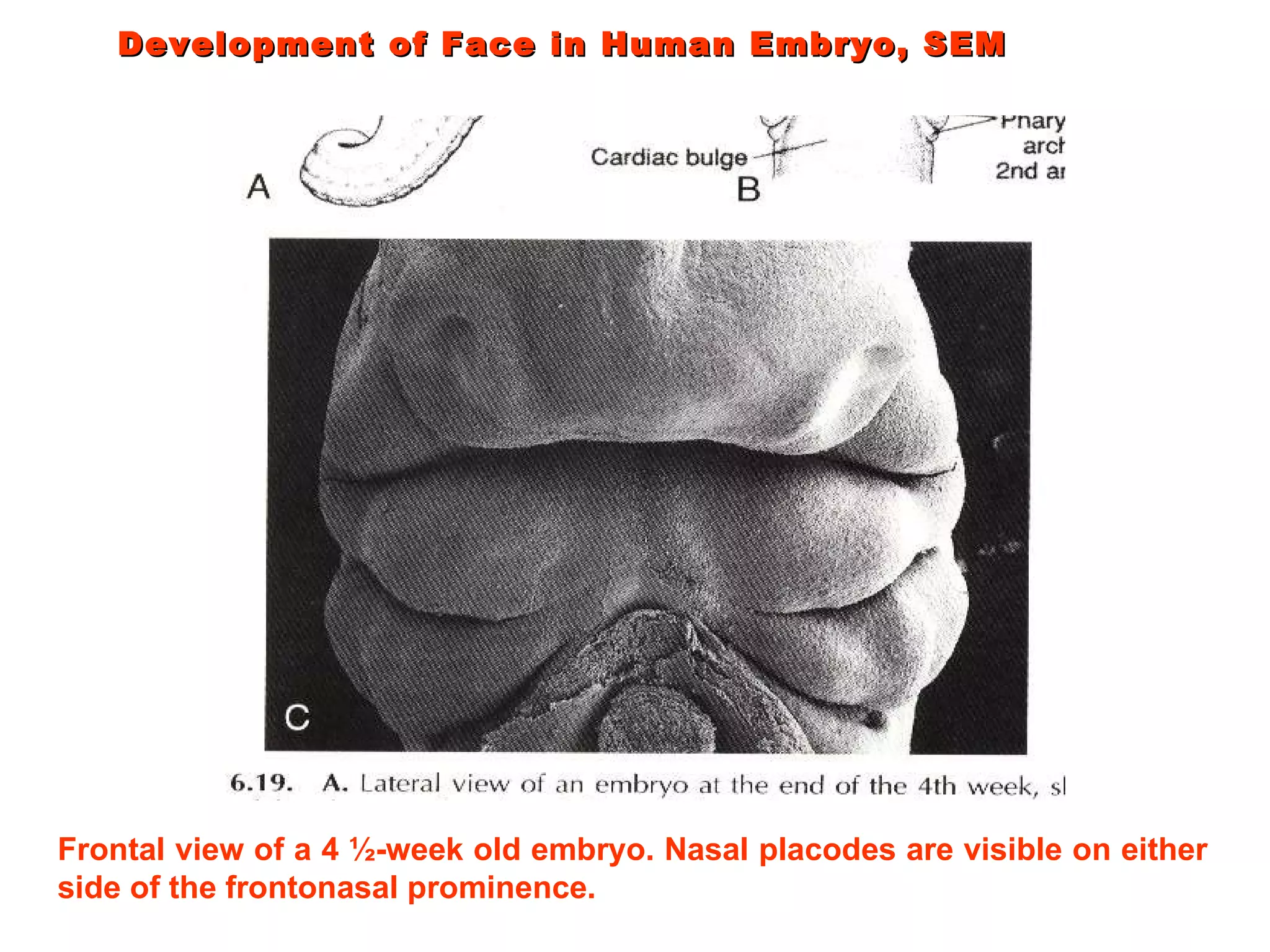 Frontal view of a 4 ½-week old embryo. Nasal placodes are visible on either side of the frontonasal prominence. Development of Face in Human Embryo, SEM  