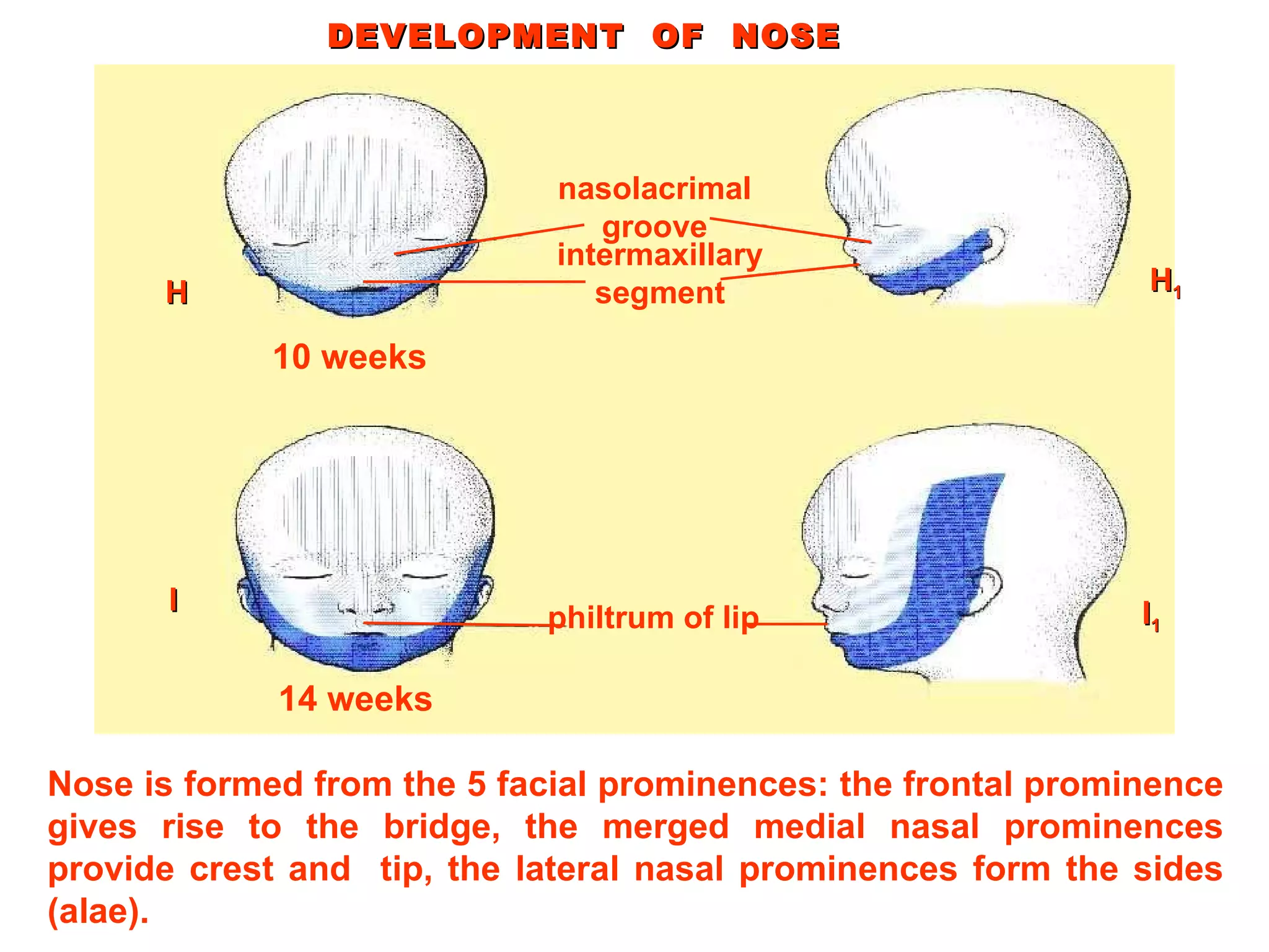 Nose is formed from the 5 facial prominences: the frontal prominence gives rise to the bridge, the merged medial nasal prominences provide crest and  tip, the lateral nasal prominences form the sides (alae). DEVELOPMENT  OF  NOSE nasolacrimal groove intermaxillary segment philtrum of lip H I H 1 I 1 10 weeks 14 weeks 