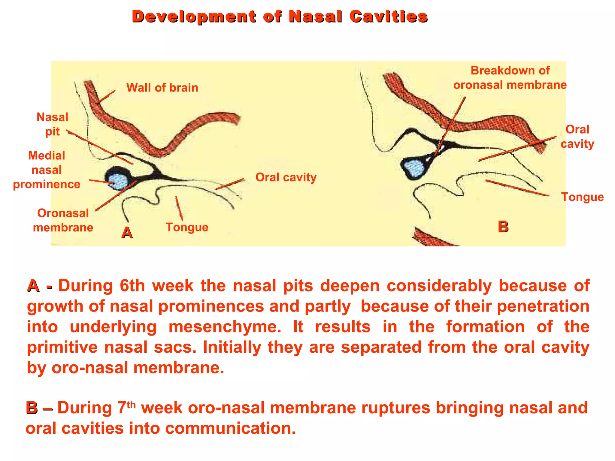 Development of Nasal Cavities B –  During 7 th  week oro-nasal membrane ruptures bringing nasal and oral cavities into communication. A -  During 6th week the nasal pits deepen considerably because of growth of nasal prominences and partly  because of their penetration into underlying mesenchyme. It results in the formation of the primitive nasal sacs. Initially they are separated from the oral cavity by oro-nasal membrane. Wall of brain Nasal pit Medial nasal prominence Oronasal membrane Oral cavity Tongue Breakdown of oronasal membrane Oral cavity Tongue A B 
