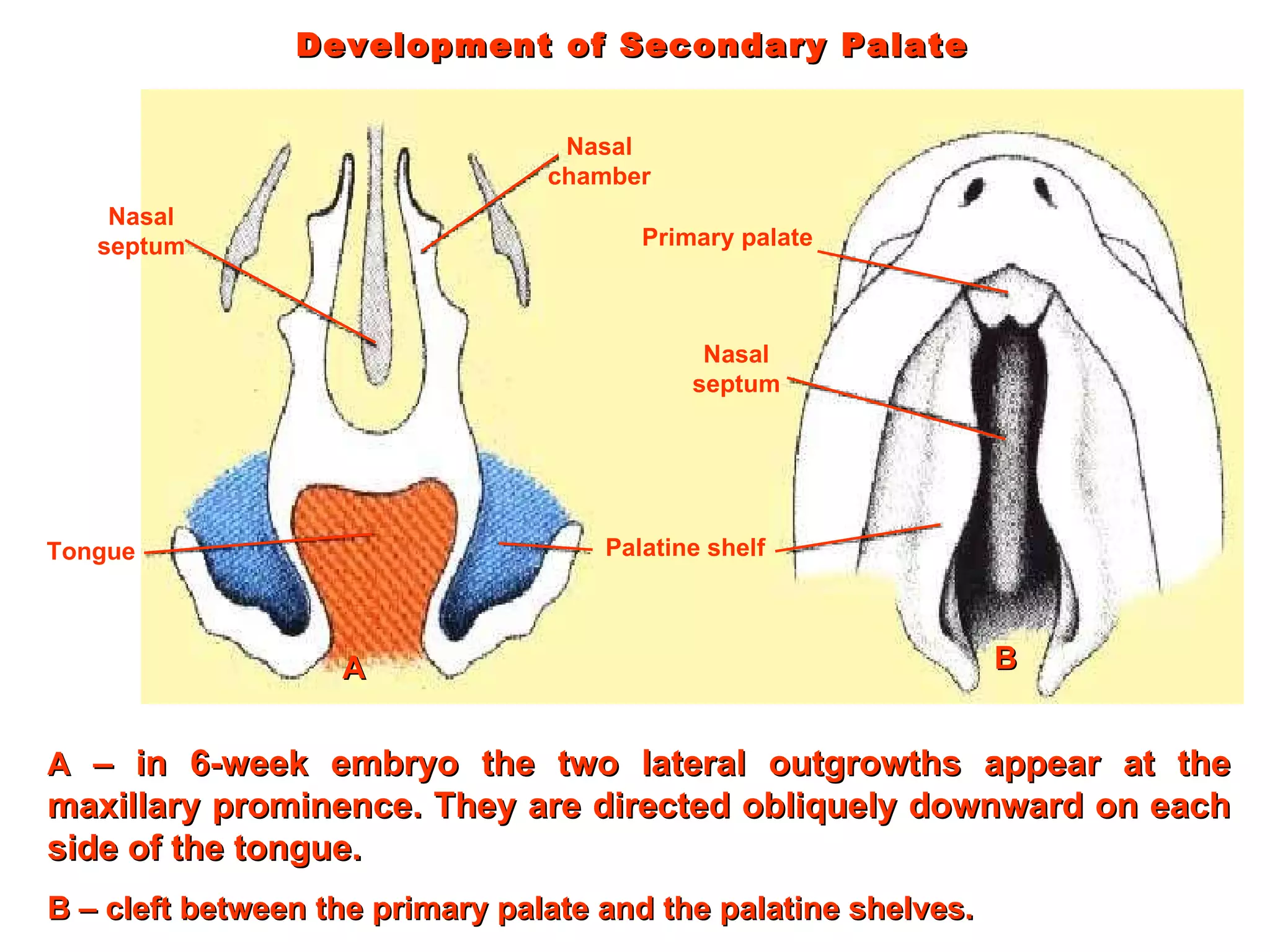 Development of Secondary Palate Nasal septum Tongue Nasal chamber Palatine shelf Primary palate Nasal septum A  – in 6-week embryo the two lateral outgrowths appear at the maxillary prominence. They are directed obliquely downward on each side of the tongue. A B – cleft between the primary palate and the palatine shelves.  B 