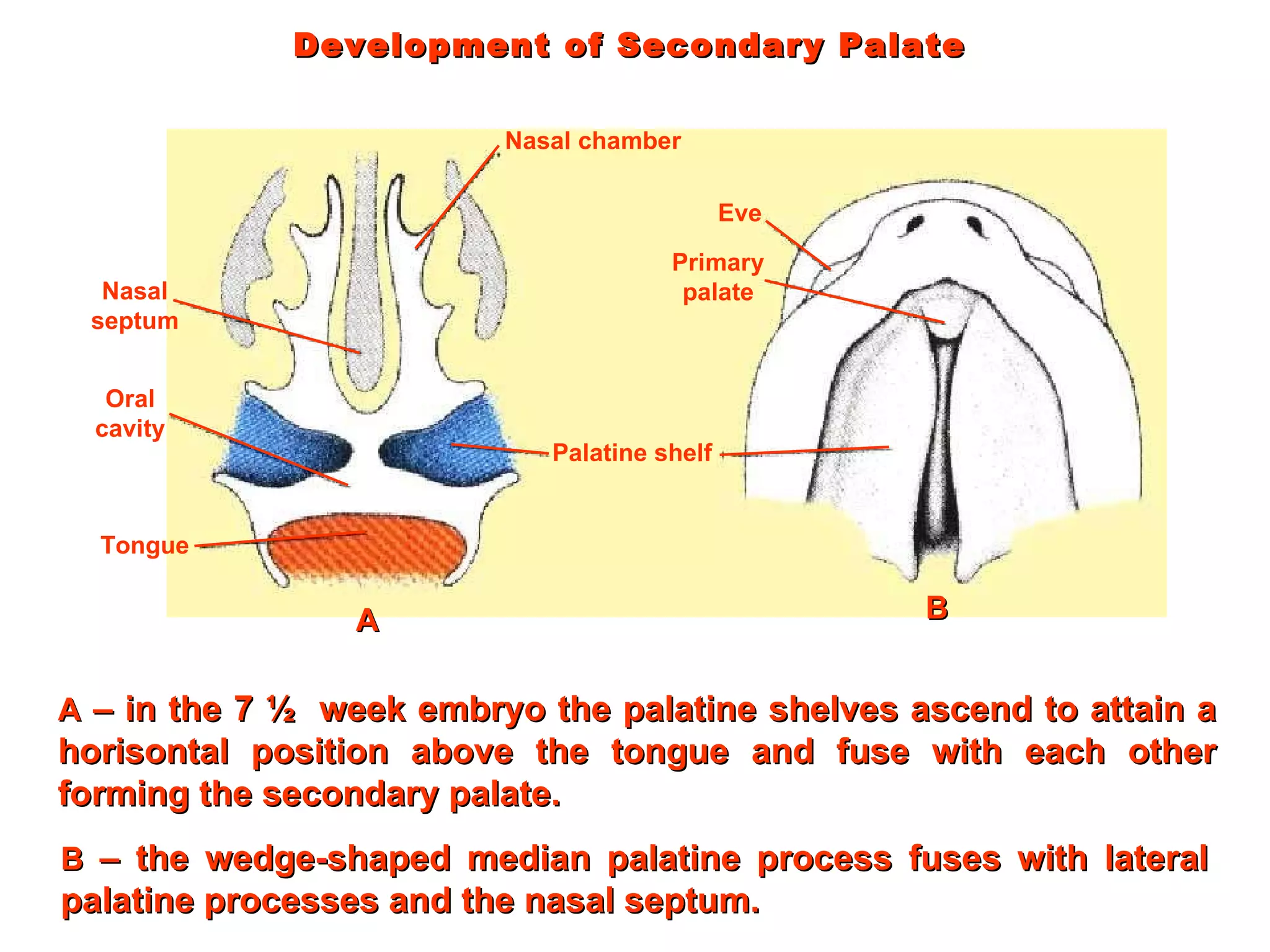 Development of Secondary Palate Nasal septum Oral cavity Tongue Palatine shelf Primary palate Eve Nasal chamber A  – in the 7 ½  week embryo the palatine shelves ascend to attain a horisontal position above the tongue and fuse with each other forming the secondary palate. A B  – the wedge-shaped median palatine process fuses with lateral palatine processes and the nasal septum.  B 