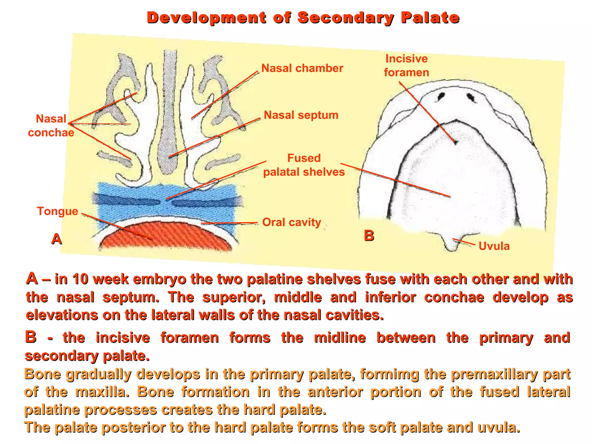Development of Secondary Palate Bone gradually develops in the primary palate, formimg the premaxillary part of the maxilla. Bone formation in the anterior portion of the fused lateral palatine processes creates the hard palate. The palate posterior to the hard palate forms the soft palate and uvula.  Nasal conchae Tongue Nasal chamber Nasal septum Fused palatal shelves Oral cavity Incisive foramen Uvula A  – in 10 week embryo the two palatine shelves fuse with each other and with the nasal septum. The superior, middle and inferior conchae develop as elevations on the lateral walls of the nasal cavities. A B  - the incisive foramen forms the midline between the primary and secondary palate. B 