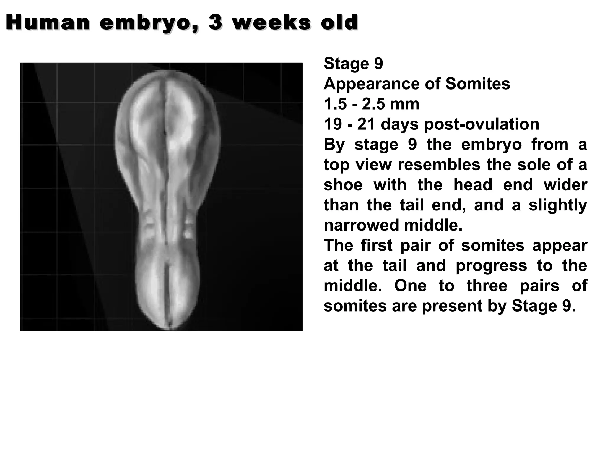 Stage 9  Appearance of Somites  1.5 - 2.5 mm 19 - 21 days post-ovulation By stage 9 the embryo from a top view resembles the sole of a shoe with the head end wider than the tail end, and a slightly narrowed middle. The first pair of somites appear at the tail and progress to the middle. One to three pairs of somites are present by Stage 9. Human embryo, 3 weeks old                                   