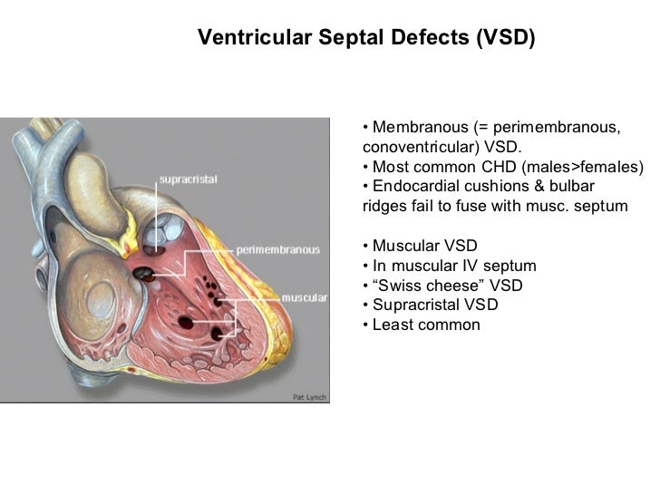 Development of heart