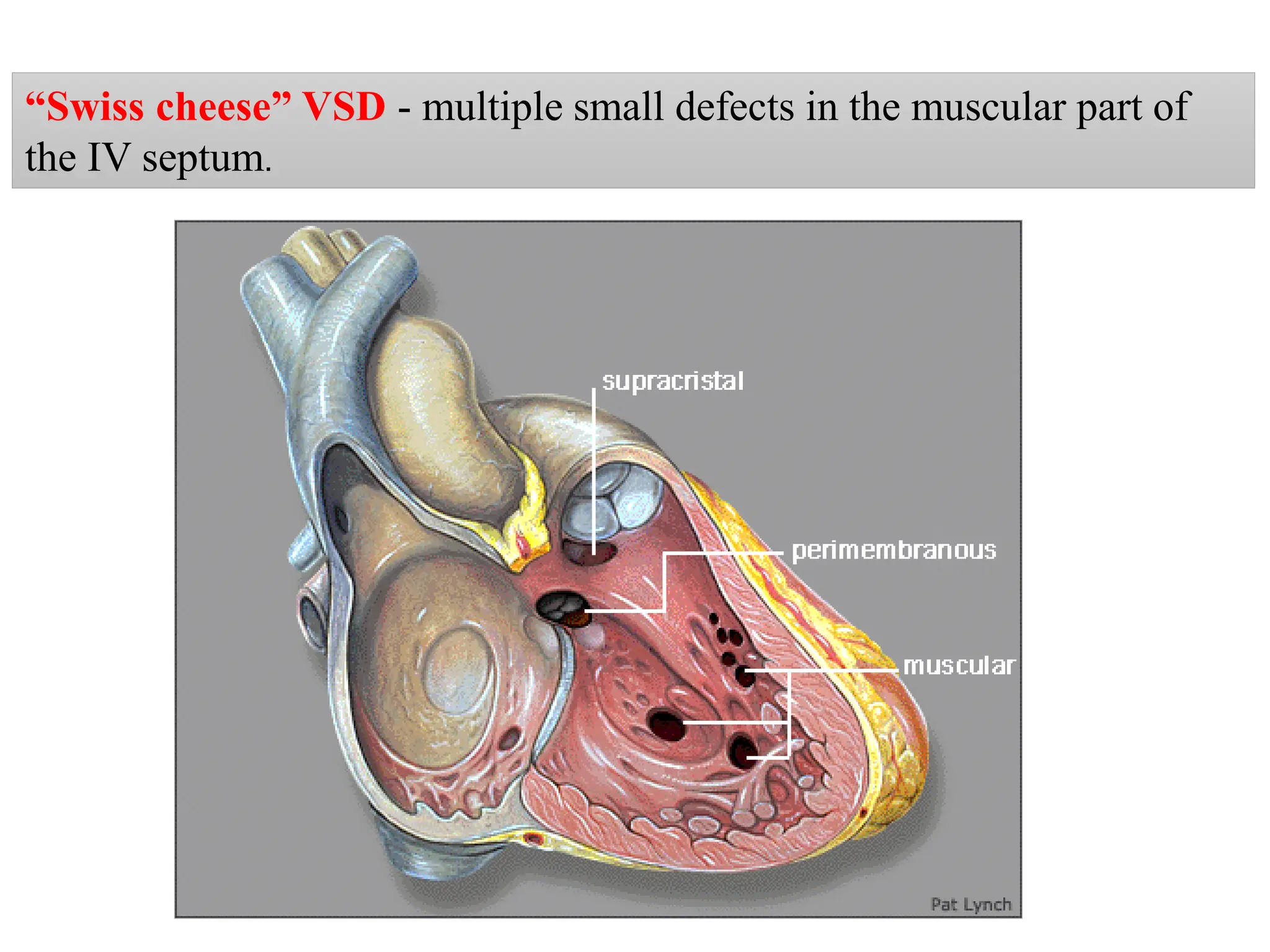 development of heart and it’s clinical abnormal | PDF | Heart and ...