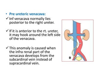 • Pre ureteric venacava:
Inf venacava normally lies
posterior to the right ureter.
If it is anterior to the rt. ureter,
it may hook around the left side
of the venacava.
This anomaly is caused when
the infra renal part of the
venacava develops from the
subcardinal vein instead of
supracardinal vein.
 