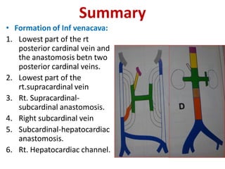 Summary
• Formation of Inf venacava:
1. Lowest part of the rt
posterior cardinal vein and
the anastomosis betn two
posterior cardinal veins.
2. Lowest part of the
rt.supracardinal vein
3. Rt. Supracardinal-
subcardinal anastomosis.
4. Right subcardinal vein
5. Subcardinal-hepatocardiac
anastomosis.
6. Rt. Hepatocardiac channel.
 
