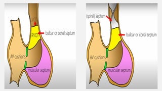 Development of Interventricular septum.pptx