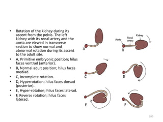 Development of kidney & its anomalies | PPTX