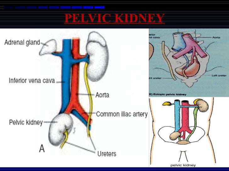 Development of kidney and ureter 05.01.12