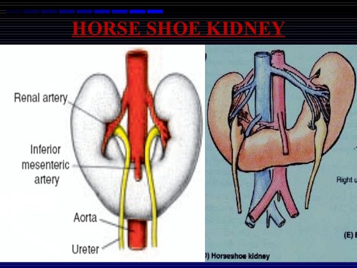 Development of kidney and ureter 05.01.12
