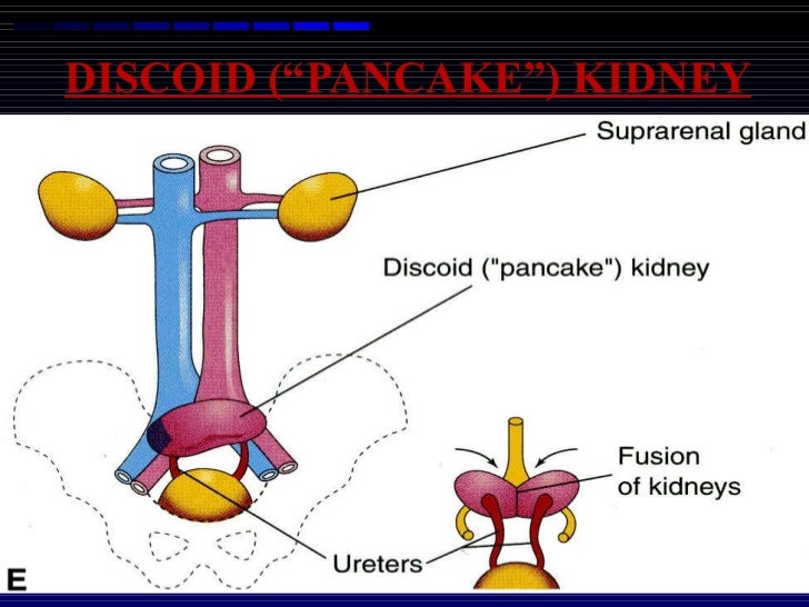 Development of kidney and ureter 05.01.12