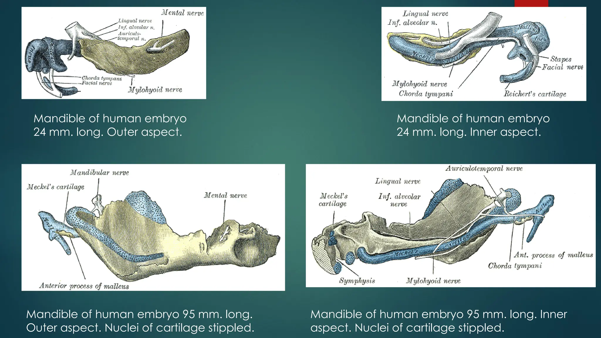 Mandible of human embryo
24 mm. long. Outer aspect.
Mandible of human embryo
24 mm. long. Inner aspect.
Mandible of human embryo 95 mm. long.
Outer aspect. Nuclei of cartilage stippled.
Mandible of human embryo 95 mm. long. Inner
aspect. Nuclei of cartilage stippled.
 