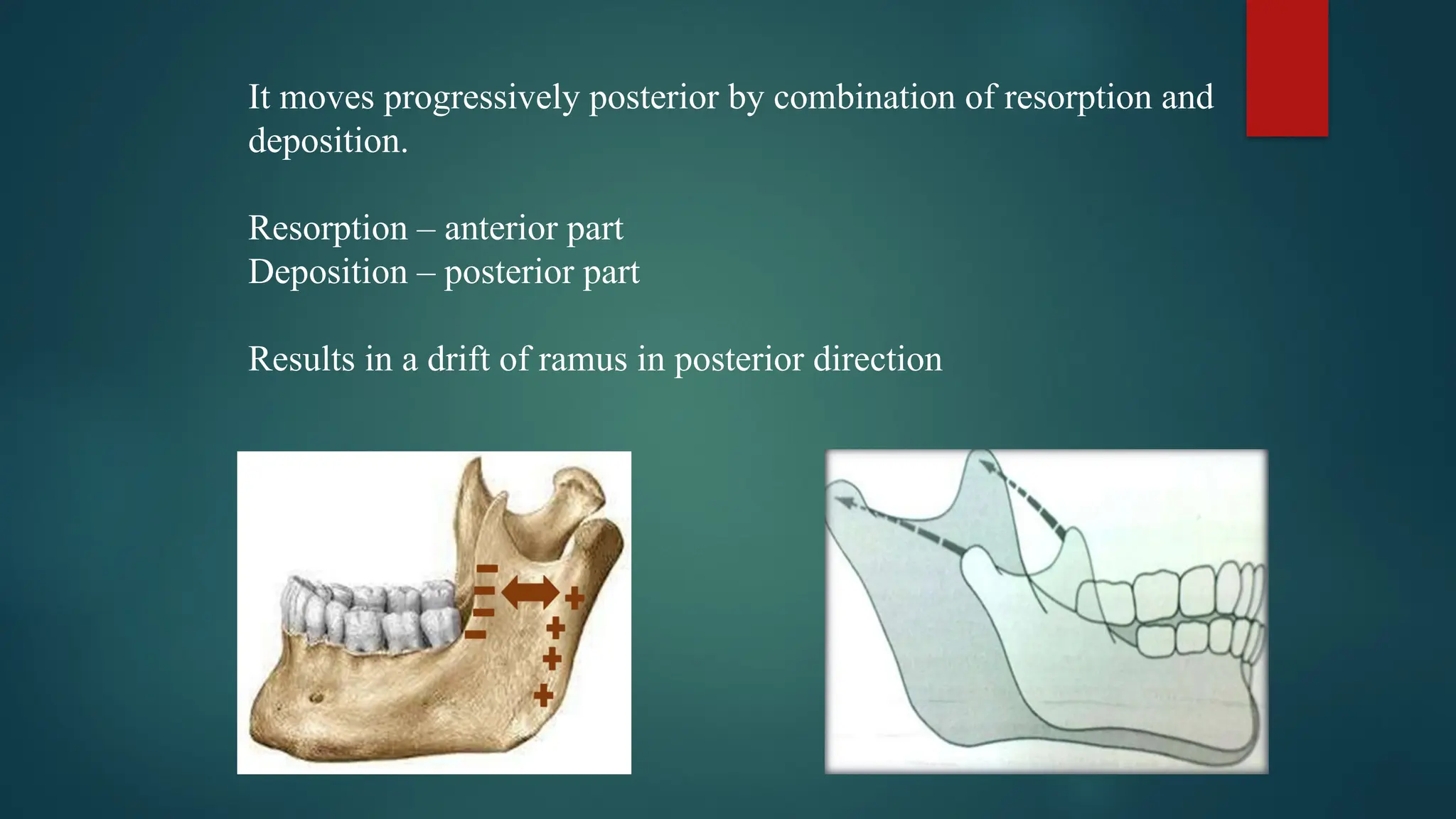 It moves progressively posterior by combination of resorption and
deposition.
Resorption – anterior part
Deposition – posterior part
Results in a drift of ramus in posterior direction
 