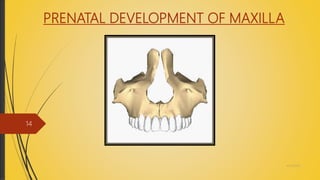 PRENATAL DEVELOPMENT OF MAXILLA
4/14/2018
14
 