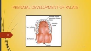 PRENATAL DEVELOPMENT OF PALATE
4/14/2018
28
 