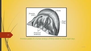 Primitive palate of a human embryo of thirty-seven to thirty-eight days.
4/14/2018
31
 