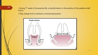 • During 7th week of intrauterine life, a transformation in the position of the palatine shelf
occurs
• They change from a vertical to a horizontal position
4/14/2018
34
 