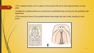 • The 2 palatal shelves, by 8 ½ weeks of intra uterine life are in close approximation to each
other
• Initially the 2 palatal shelves are covered by an epithelial lining. As they join the epithelial cells
degenerate
• The connective tissue of the palatal shelves intermingle with each other resulting in their
fusion
4/14/2018
36
 