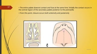 • The entire palate doesnot contact and fuse at the same time. Initially the contact occurs in
the central region of the secondary palate posterior to the premaxilla
• From this point, closure occurs both anteriorly and posteriorly
4/14/2018
37
 