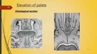 Elevation of palate
Histological section
4/14/2018
41
 