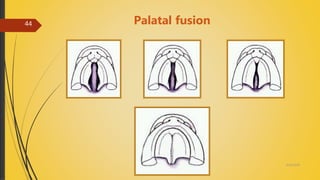 Palatal fusion
4/14/2018
44
 