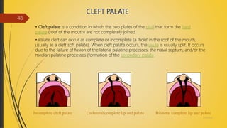 CLEFT PALATE
• Cleft palate is a condition in which the two plates of the skull that form the hard
palate (roof of the mouth) are not completely joined
• Palate cleft can occur as complete or incomplete (a 'hole' in the roof of the mouth,
usually as a cleft soft palate). When cleft palate occurs, the uvula is usually split. It occurs
due to the failure of fusion of the lateral palatine processes, the nasal septum, and/or the
median palatine processes (formation of the secondary palate
Incomplete cleft palate Unilateral complete lip and palate Bilateral complete lip and palate
4/14/2018
48
 