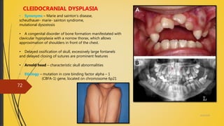 4/14/2018
72
CLEIDOCRANIAL DYSPLASIA
• Synonyms – Marie and sainton’s disease,
scheuthauer- marie- sainton syndrome,
mutational dysostosis
• A congenital disorder of bone formation manifestated with
clavicular hypoplasia with a norrow thorax, which allows
approximation of shoulders in front of the chest.
• Delayed ossification of skull, excessively large fontanels
and delayed closing of sutures are prominent features
• Arnold head – characteristic skull abnormalities
• Etiology – mutation in core binding factor alpha – 1
(CBFA-1) gene, located on chromosome 6p21
 