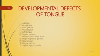 DEVELOPMENTAL DEFECTS
OF TONGUE
4/14/2018
90
1. Aglossia
2. Microglossia
3. Macroglossia
4. Ankyloglossia
5. Cleft tongue
6. Fissured tongue
7. Median rhomboid glossitis
8. Benign migratory glossitis
9. Hairy tongue
10. Lingual varices
11. Lingual thyroid nodule
 