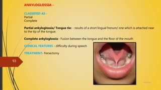 4/14/2018
93
ANKYLOGLOSSIA -
CLASSIFIED AS -
Partial
Complete
Partial ankyloglossia/ Tongue tie: - results of a short lingual frenum/ one which is attached near
to the tip of the tongue.
Complete ankyloglossia:- Fusion between the tongue and the floor of the mouth
CLINICAL FEATURES - difficulty during speech
TREATMENT- frenectomy
 