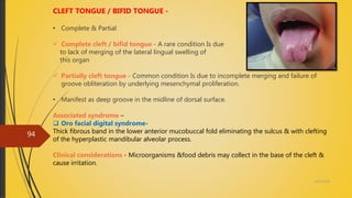 4/14/2018
94
CLEFT TONGUE / BIFID TONGUE -
• Complete & Partial
 Complete cleft / bifid tongue - A rare condition Is due
to lack of merging of the lateral lingual swelling of
this organ
 Partially cleft tongue - Common condition Is due to incomplete merging and failure of
groove obliteration by underlying mesenchymal proliferation.
• Manifest as deep groove in the midline of dorsal surface.
Associated syndrome –
 Oro facial digital syndrome-
Thick fibrous band in the lower anterior mucobuccal fold eliminating the sulcus & with clefting
of the hyperplastic mandibular alveolar process.
Clinical considerations - Microorganisms &food debris may collect in the base of the cleft &
cause irritation.
 