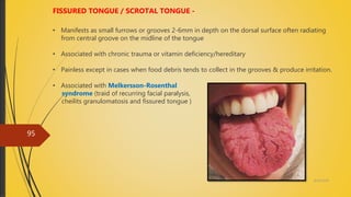 4/14/2018
95
FISSURED TONGUE / SCROTAL TONGUE -
• Manifests as small furrows or grooves 2-6mm in depth on the dorsal surface often radiating
from central groove on the midline of the tongue
• Associated with chronic trauma or vitamin deficiency/hereditary
• Painless except in cases when food debris tends to collect in the grooves & produce irritation.
• Associated with Melkersson-Rosenthal
syndrome (traid of recurring facial paralysis,
cheilits granulomatosis and fissured tongue )
 