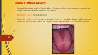 4/14/2018
96
MEDIAN RHOMBOID GLOSSITIS -
• Congenital anomaly which is due to failure of the tuberculum impar to retract or withdraw
before fusion of the lateral halves of the tongue
• Etiological agent - candida albicans
• CLINICAL FEATURES - it appears as an ovoid ,diamond, rhomboid shaped reddish patch or
plaque on the dorsal surface of the tongue, immediately anterior to circumvallate papillae
 