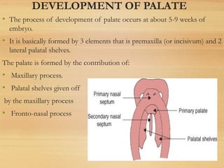 DEVELOPMENT OF PALATE
• The process of development of palate occurs at about 5-9 weeks of
embryo.
• It is basically formed by 3 elements that is premaxilla (or incisivum) and 2
lateral palatal shelves.
The palate is formed by the contribution of:
• Maxillary process.
• Palatal shelves given off
by the maxillary process
• Fronto-nasal process
 
