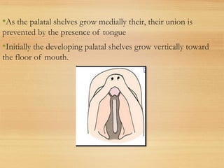 •As the palatal shelves grow medially their, their union is
prevented by the presence of tongue
•Initially the developing palatal shelves grow vertically toward
the floor of mouth.
 