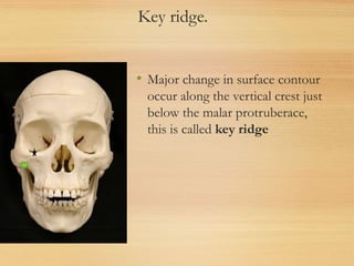 Key ridge.
• Major change in surface contour
occur along the vertical crest just
below the malar protruberace,
this is called key ridge
 