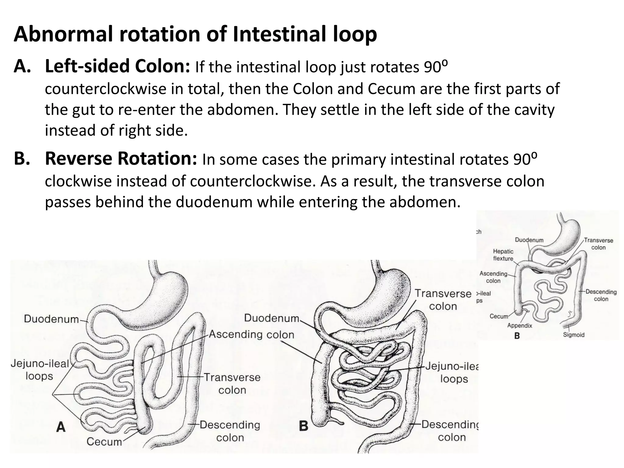 Development of midgut and pancreas | PDF