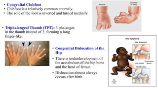 • Congenital Clubfoot
• Clubfoot is a relatively common anomaly.
• The sole of the foot is inverted and turned medially
• Congenital Dislocation of the
Hip
• There is underdevelopment of
the acetabulum of the hip bone
and the head of femur.
• Dislocation almost always
occurs after birth.
• Triphalangeal Thumb (TPT): 3 phalanges
in the thumb instead of 2, forming a long
finger-like.
 